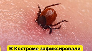 В Костроме зафиксировали и подтвердили первый в этом сезоне случай клещевого вирусного энцефалита!